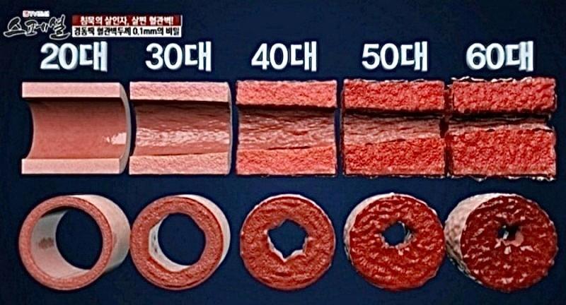 젊음이 소중한 이유.......
