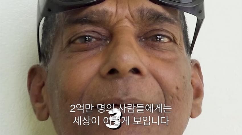 시각장애인 천명 수술시켜 준 미스터 비스트ㄷㄷ