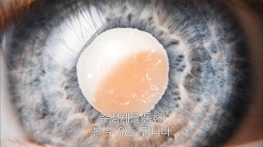 시각장애인 천명 수술시켜 준 미스터 비스트ㄷㄷ