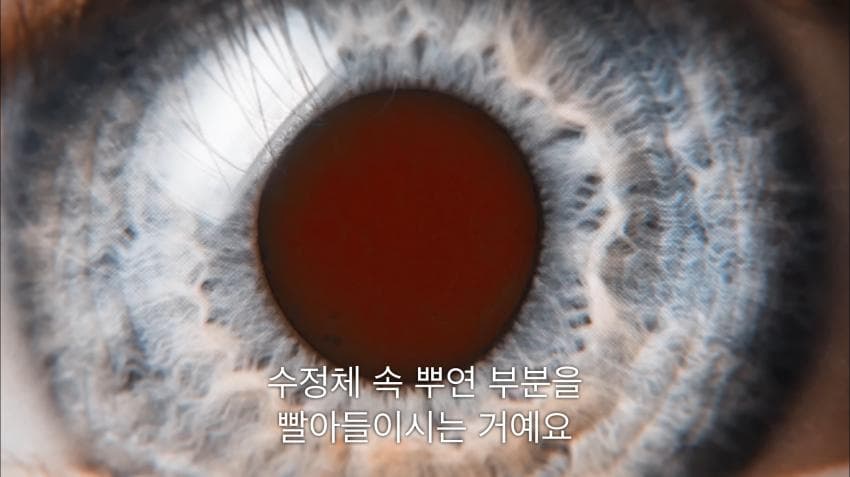 시각장애인 천명 수술시켜 준 미스터 비스트ㄷㄷ