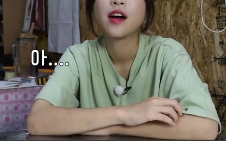 이제보니 팔뚝에 멍을 달고 살았던 쯔양
