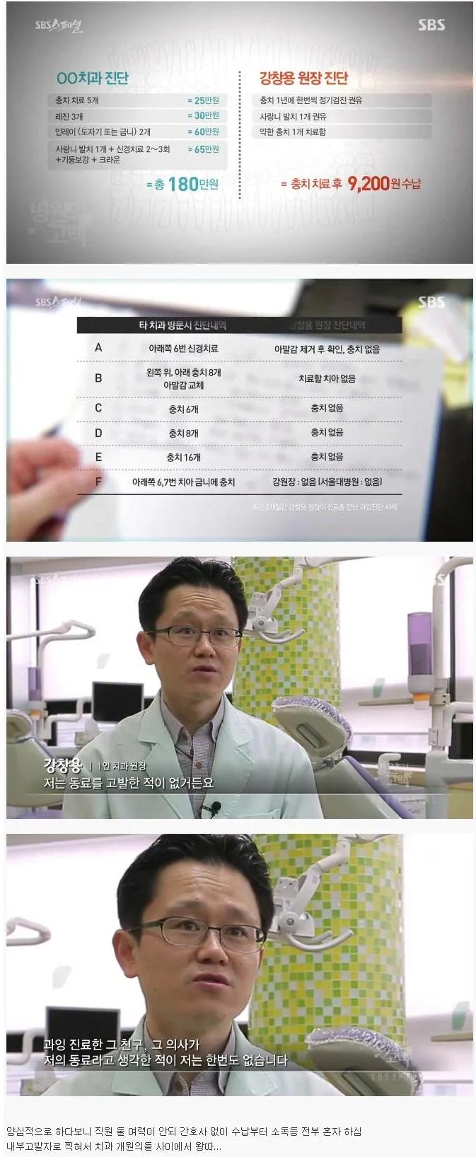치과 과잉 치료 무섭네 ㄷㄷㄷㄷ