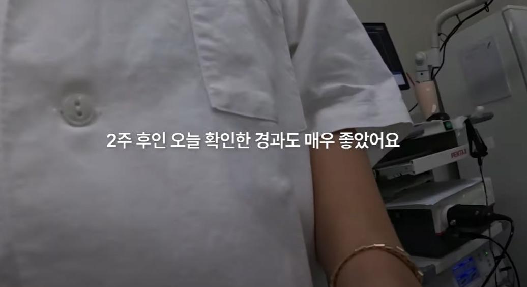 암에걸렸다는 장근석 근황
