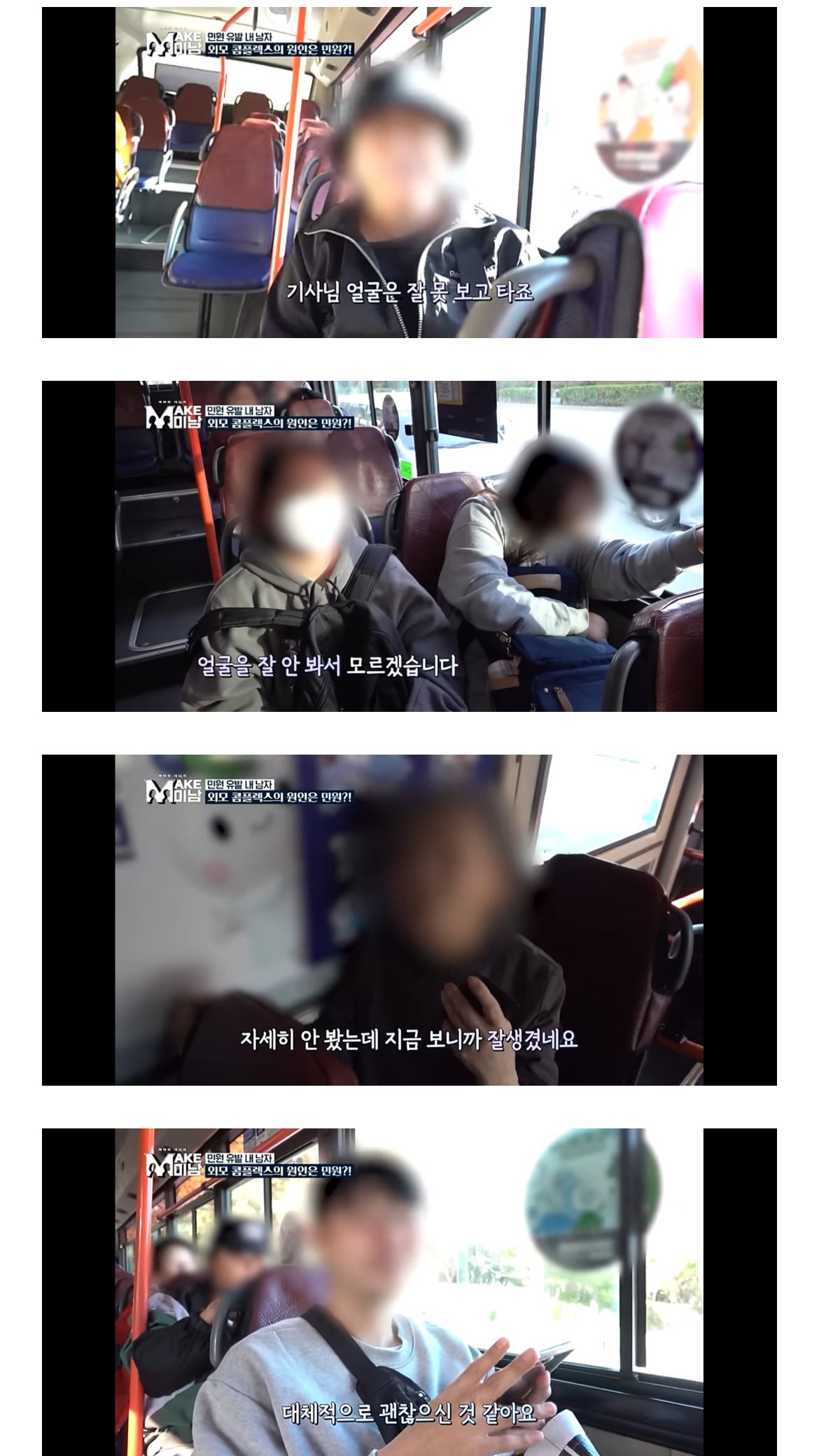 못생겼단 민원받고 성형한 28세 버스기사