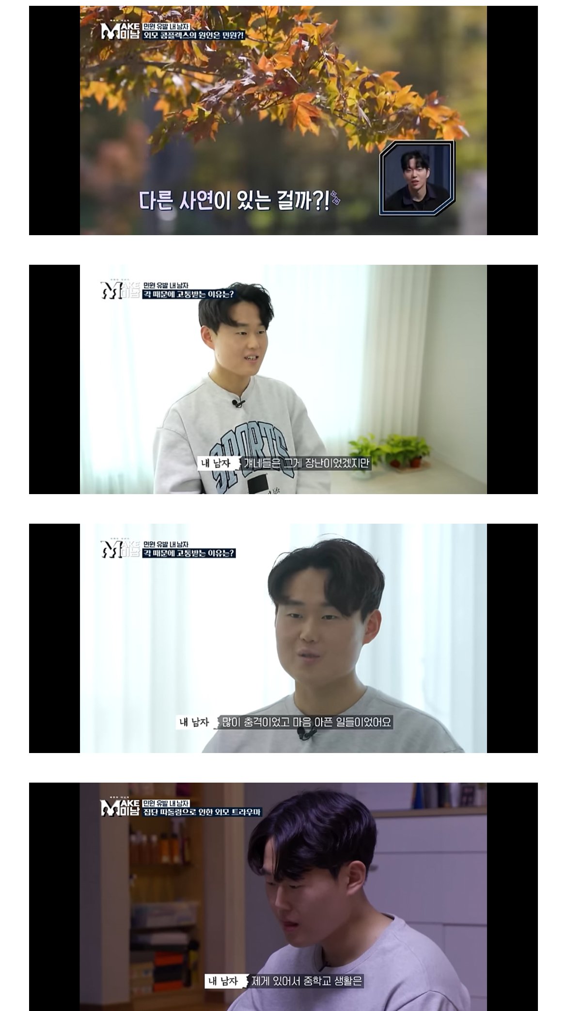 못생겼단 민원받고 성형한 28세 버스기사