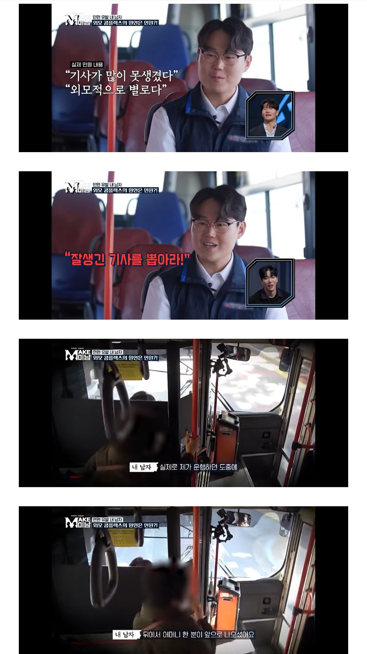 못생겼단 민원받고 성형한 28세 버스기사