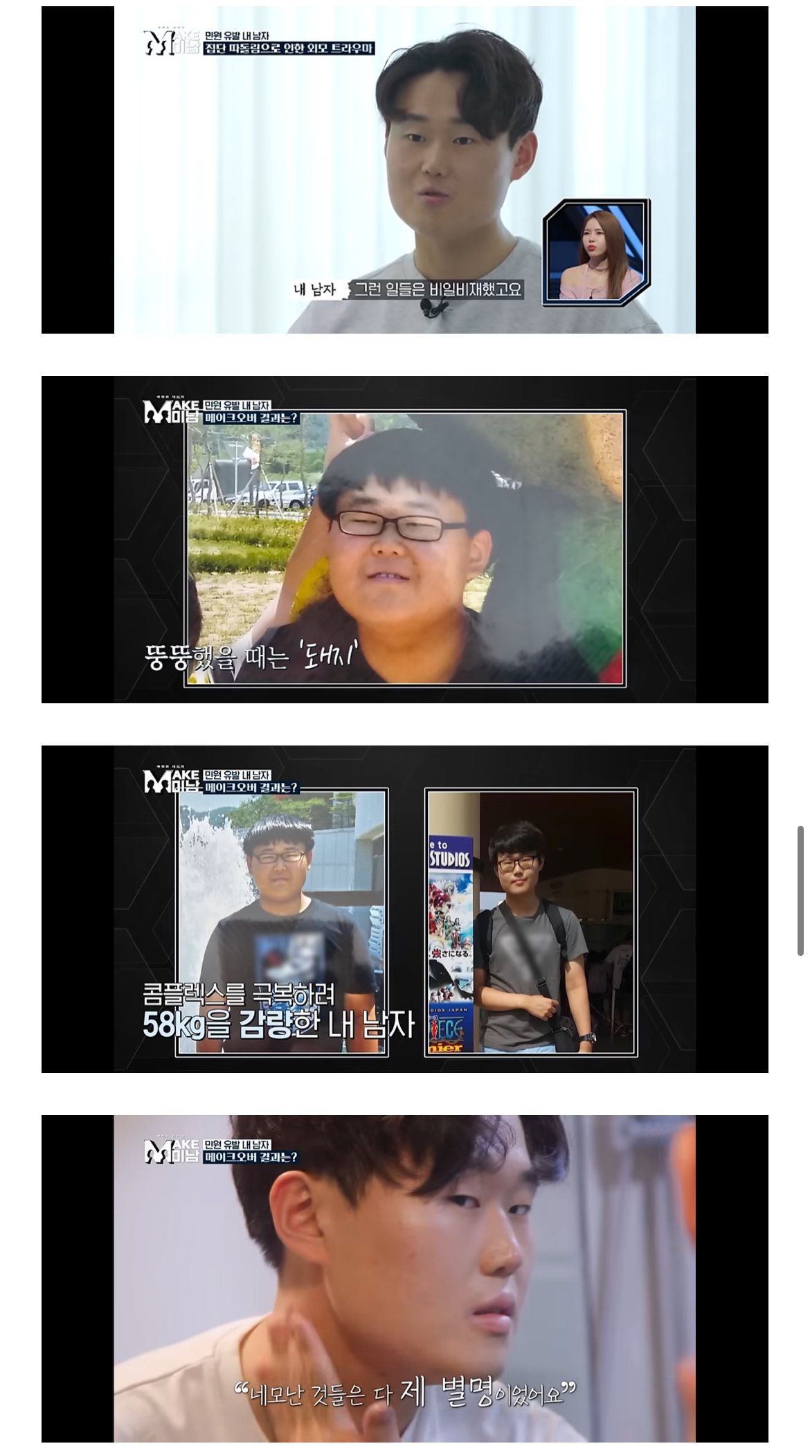 못생겼단 민원받고 성형한 28세 버스기사