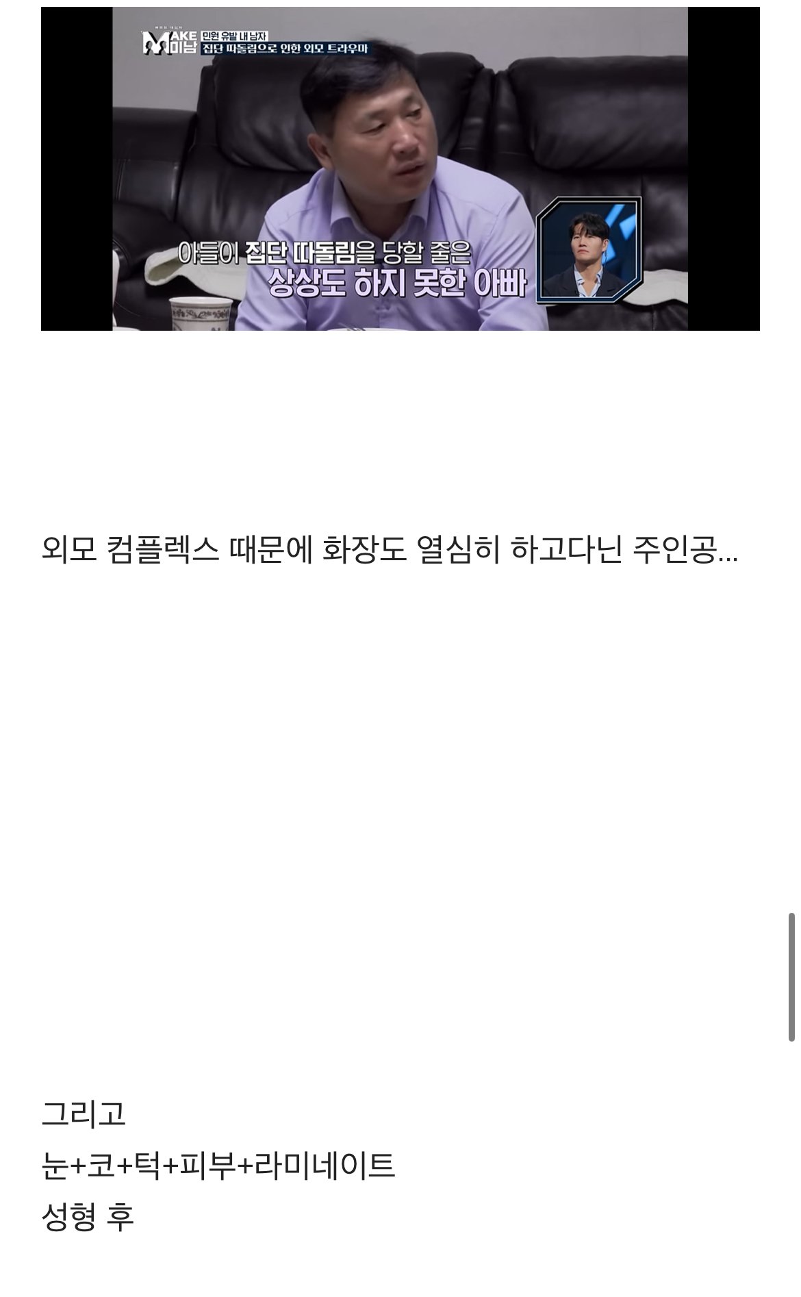 못생겼단 민원받고 성형한 28세 버스기사