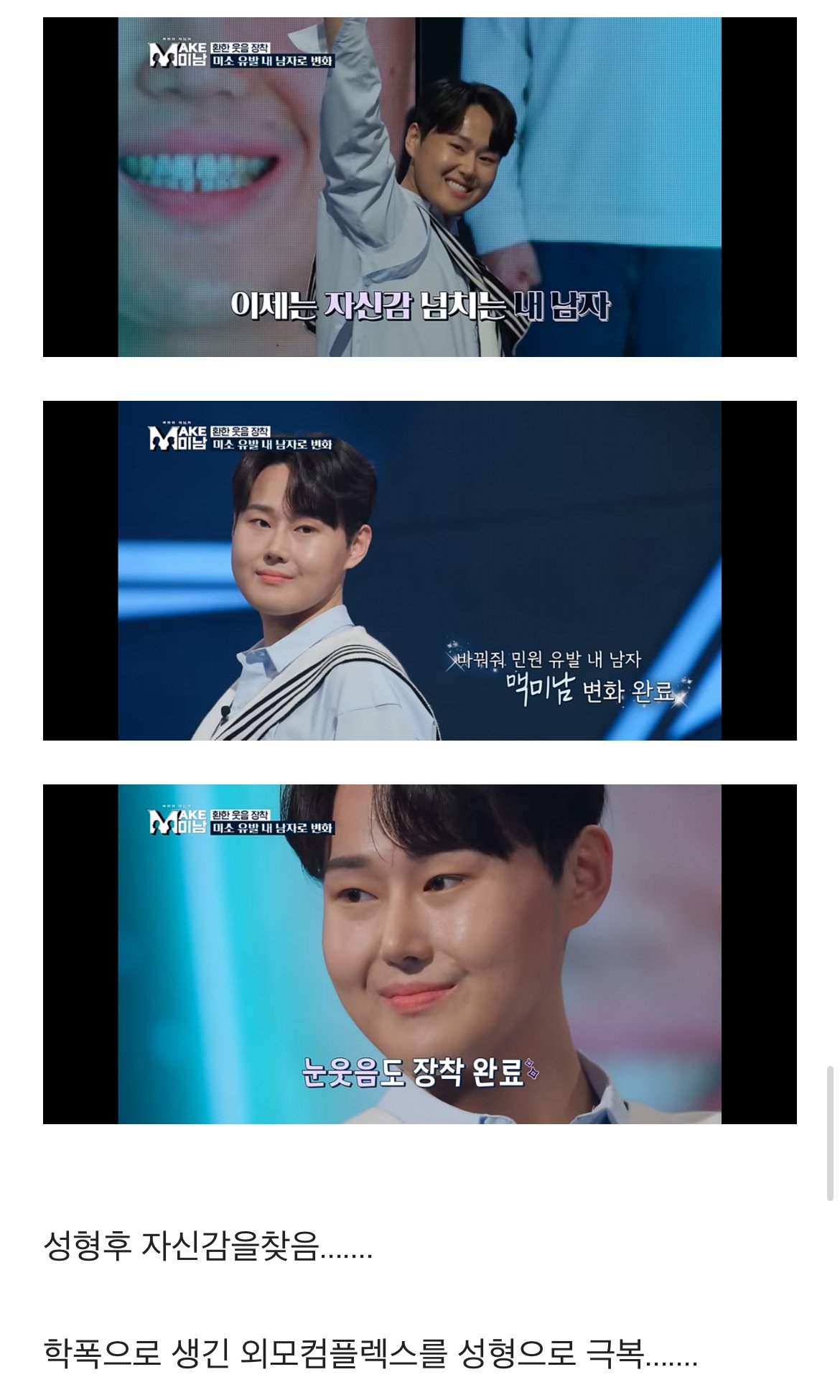 못생겼단 민원받고 성형한 28세 버스기사