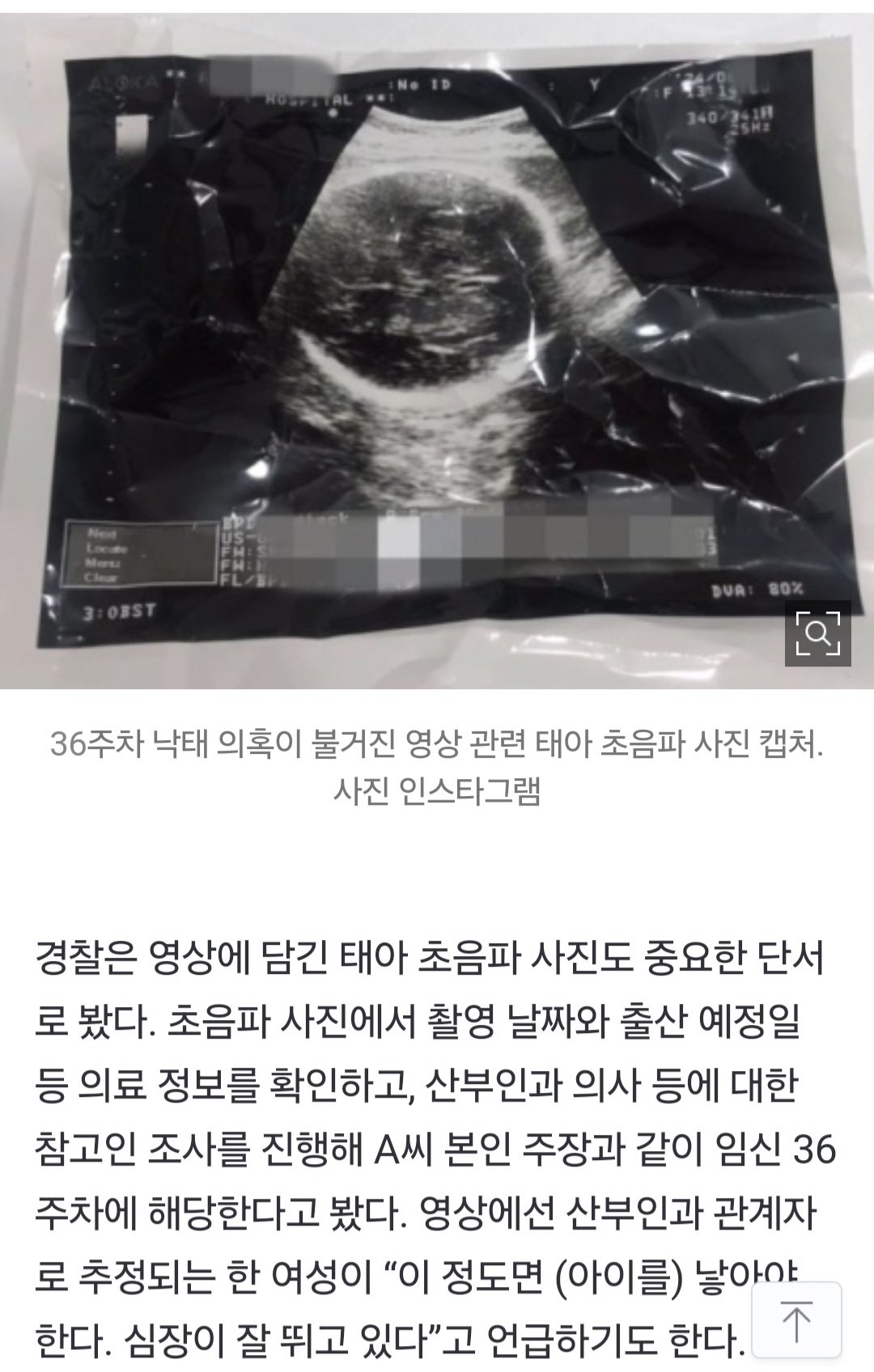 [단독] 숏폼 파보니 진짜…'36주 낙태' 영상에 담긴 수사 단초