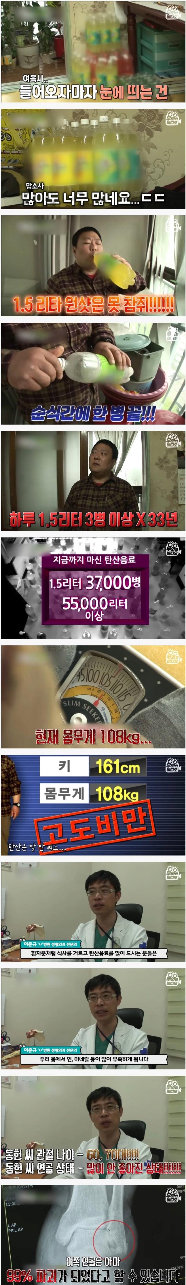 탄산음료 1.5리터 하루 3병 마시는 사람 몸 상태