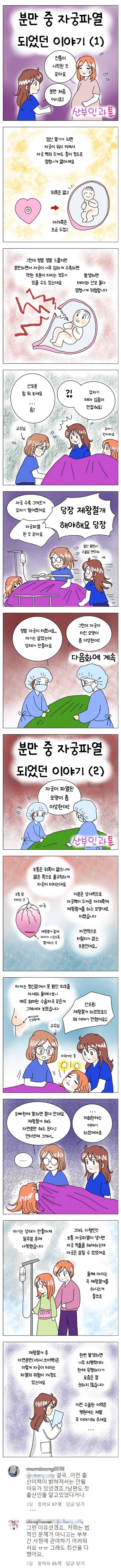 분만 중 자궁파열된 이야기 ㄷㄷㄷ