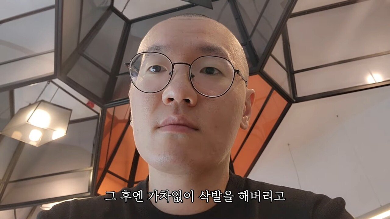 터키에 모발이식하러 갔다가 삭발만 하고 온 유튜버.
