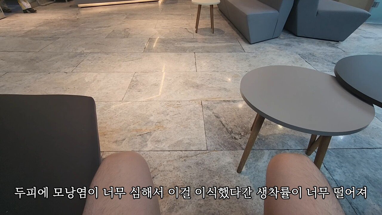 터키에 모발이식하러 갔다가 삭발만 하고 온 유튜버.