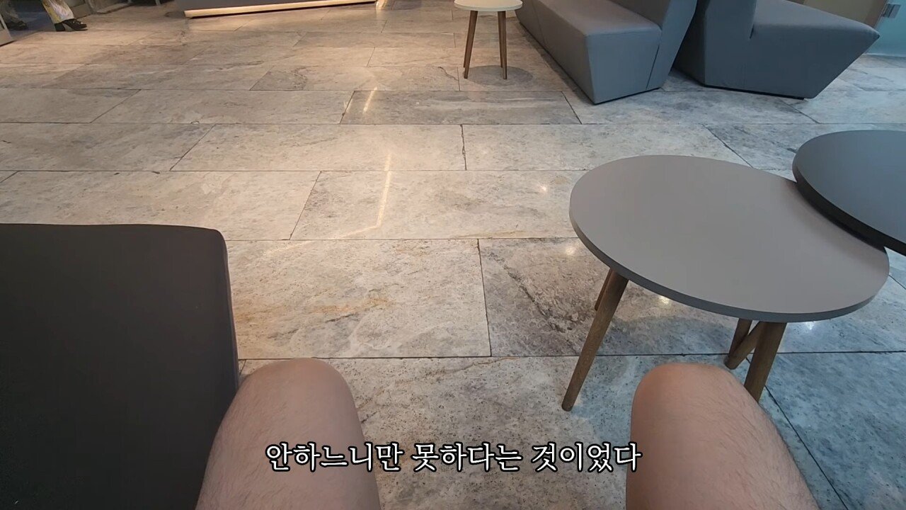 터키에 모발이식하러 갔다가 삭발만 하고 온 유튜버.