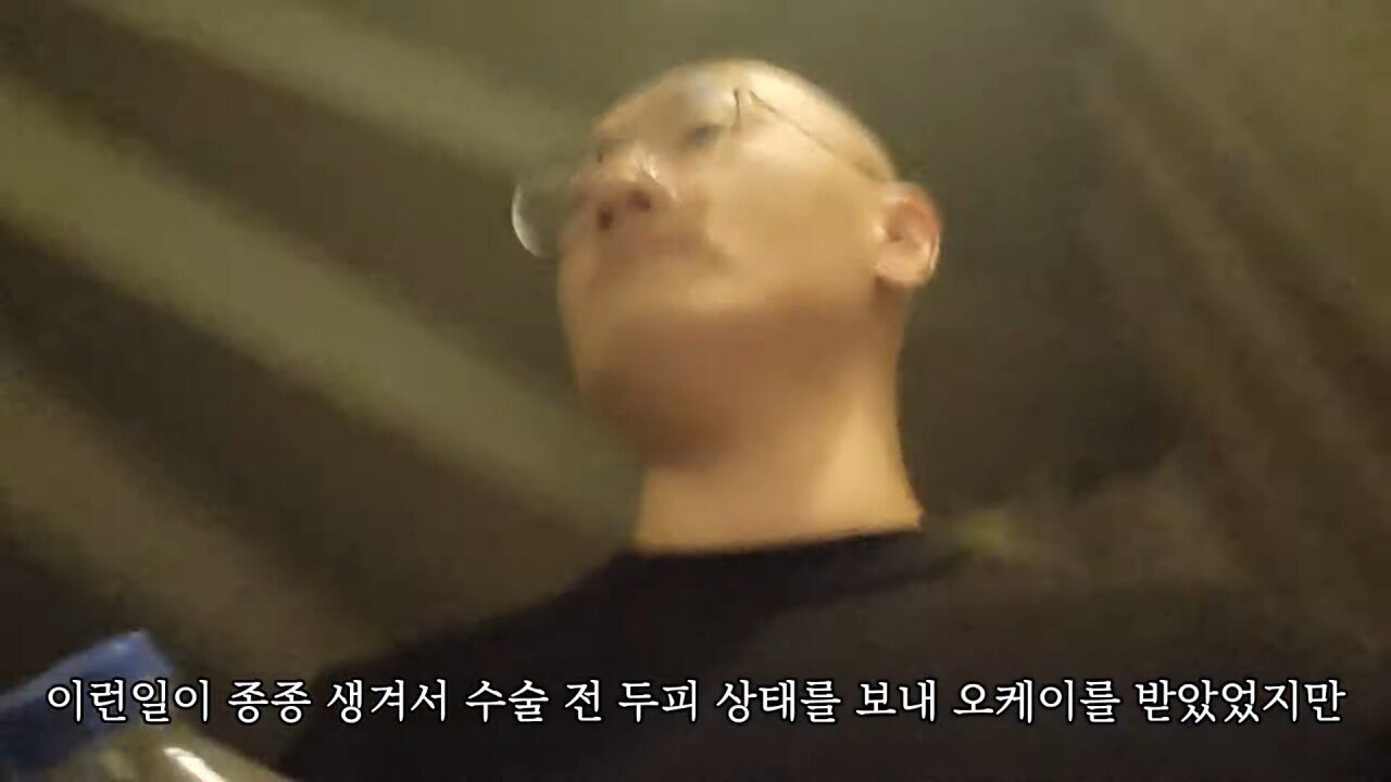 터키에 모발이식하러 갔다가 삭발만 하고 온 유튜버.