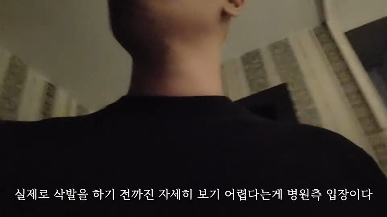 터키에 모발이식하러 갔다가 삭발만 하고 온 유튜버.