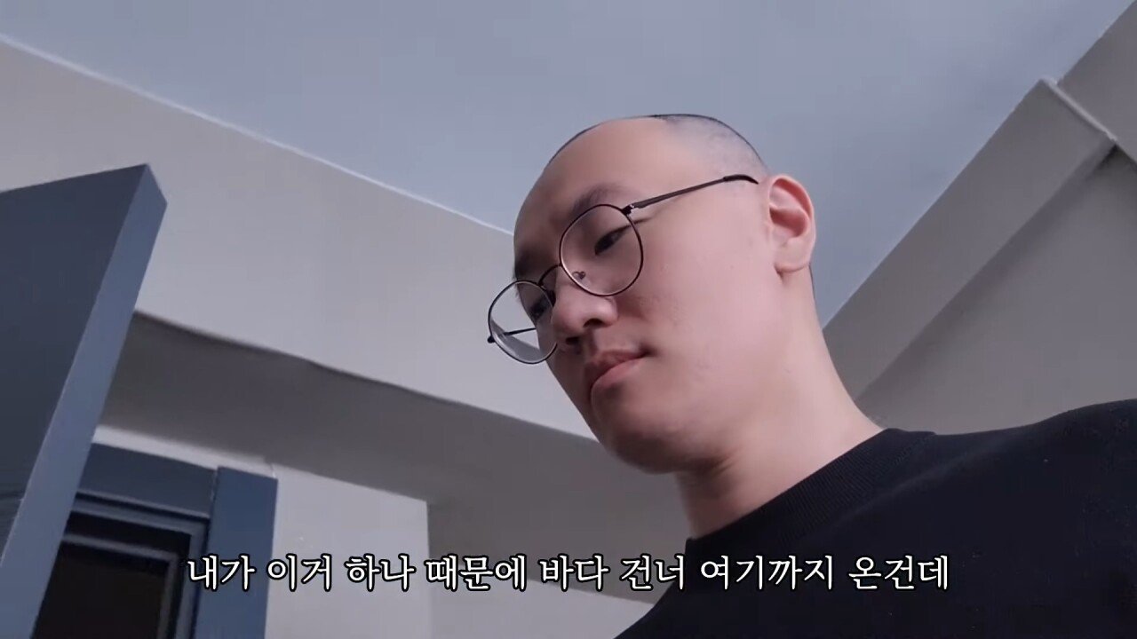 터키에 모발이식하러 갔다가 삭발만 하고 온 유튜버.
