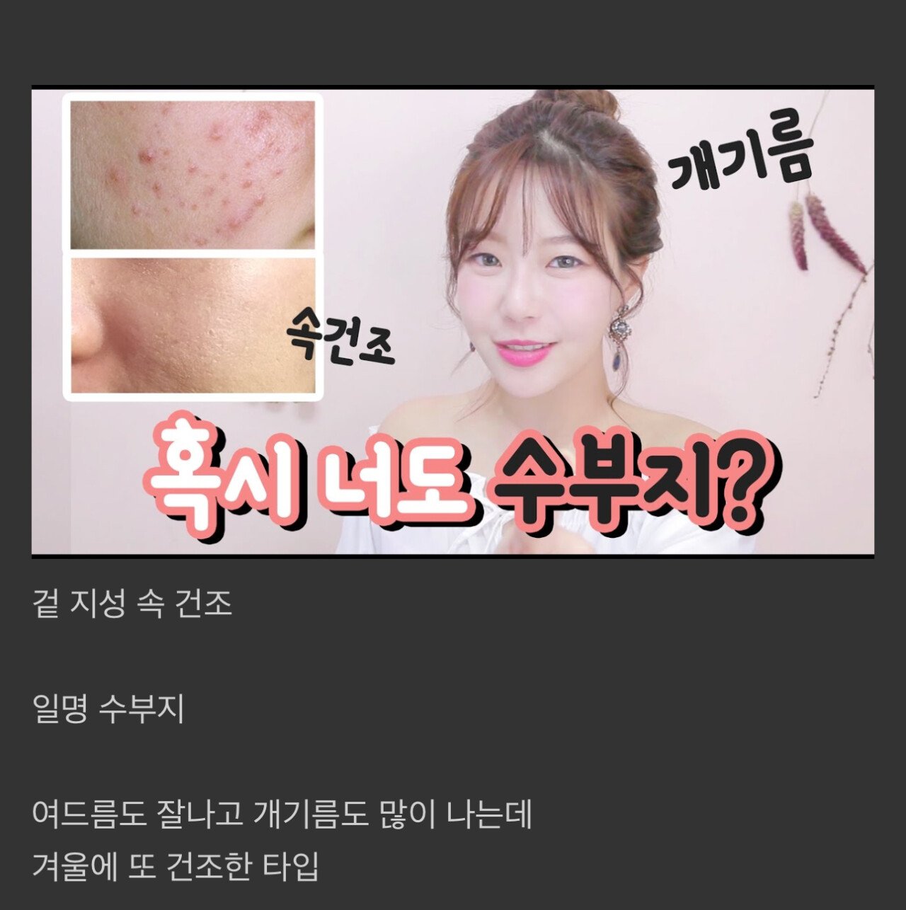 피부과 의사들이 최악으로 뽑은 피부 타입