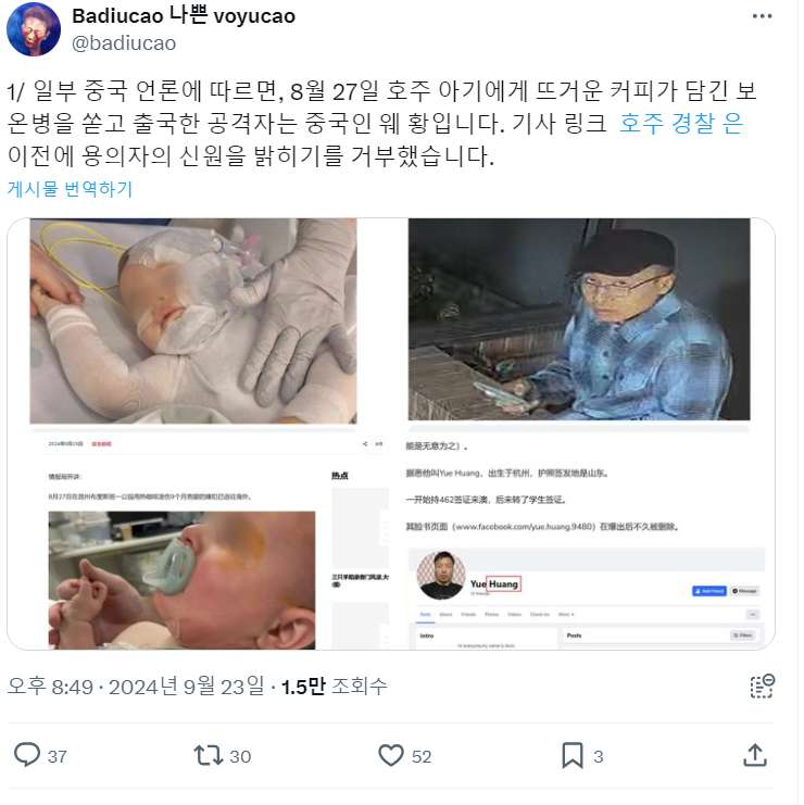 얼마전 호주에서 일어난 아기 커피 테러사건 근황