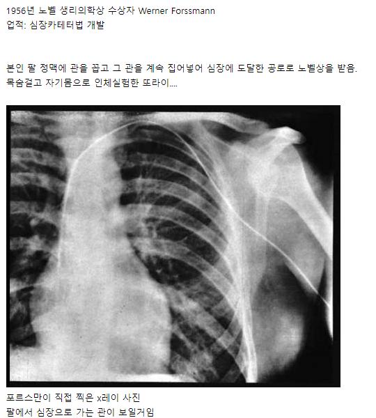 역대 노벨상 수상자 중 또라이 원탑 ㄷㄷㄷ