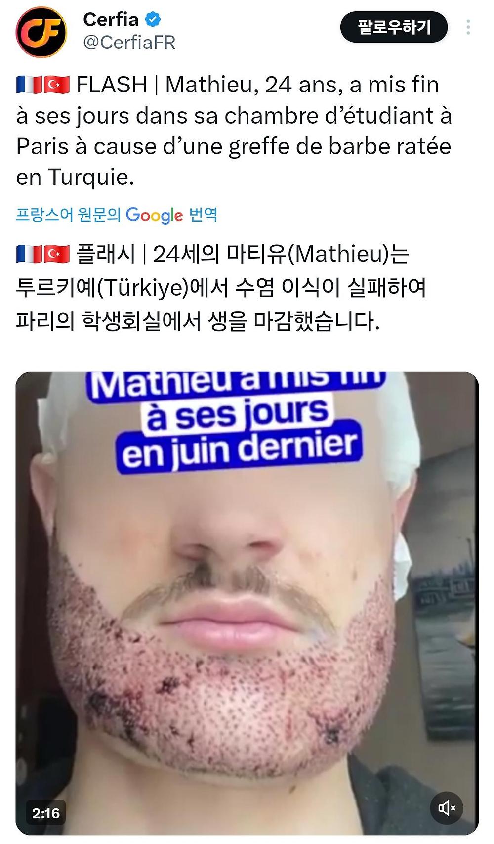 혐) 어느 프랑스 20대 남성 자살 이유