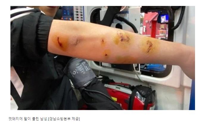 지하철역서 100kg 멧돼지 난동 팔 물린 30대 병원 이송