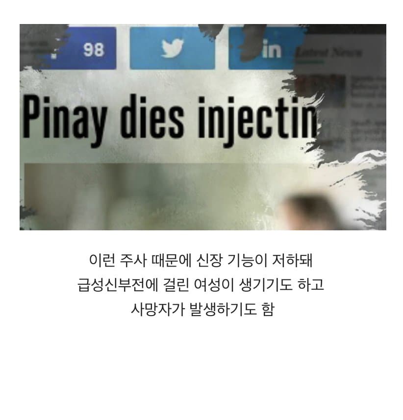 BBC 하얀피부 집착