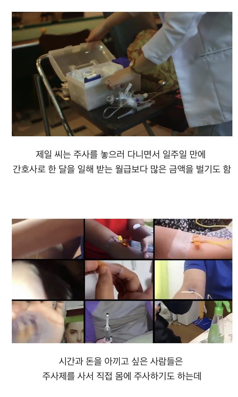 BBC 하얀피부 집착