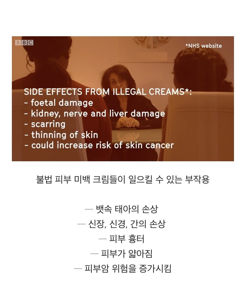 BBC 하얀피부 집착