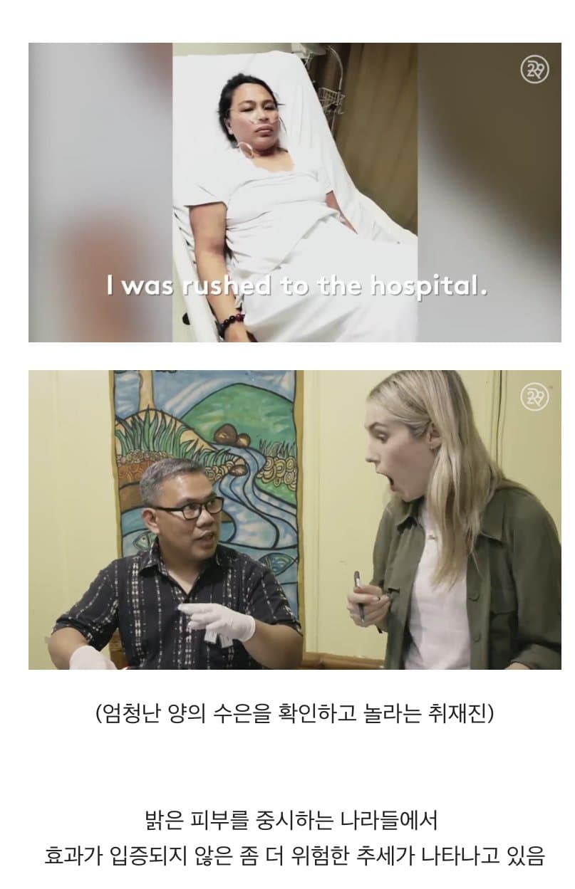 BBC 하얀피부 집착