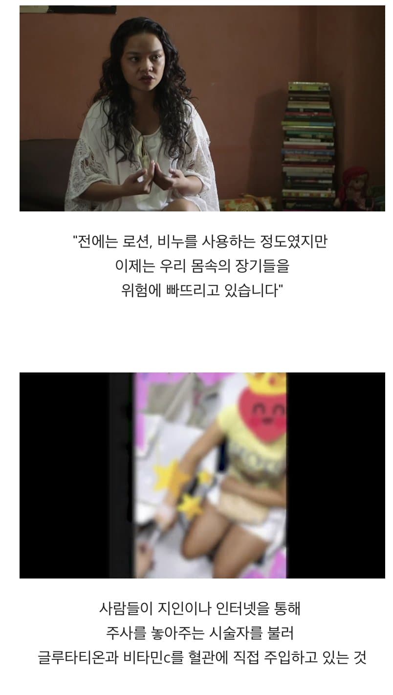 BBC 하얀피부 집착