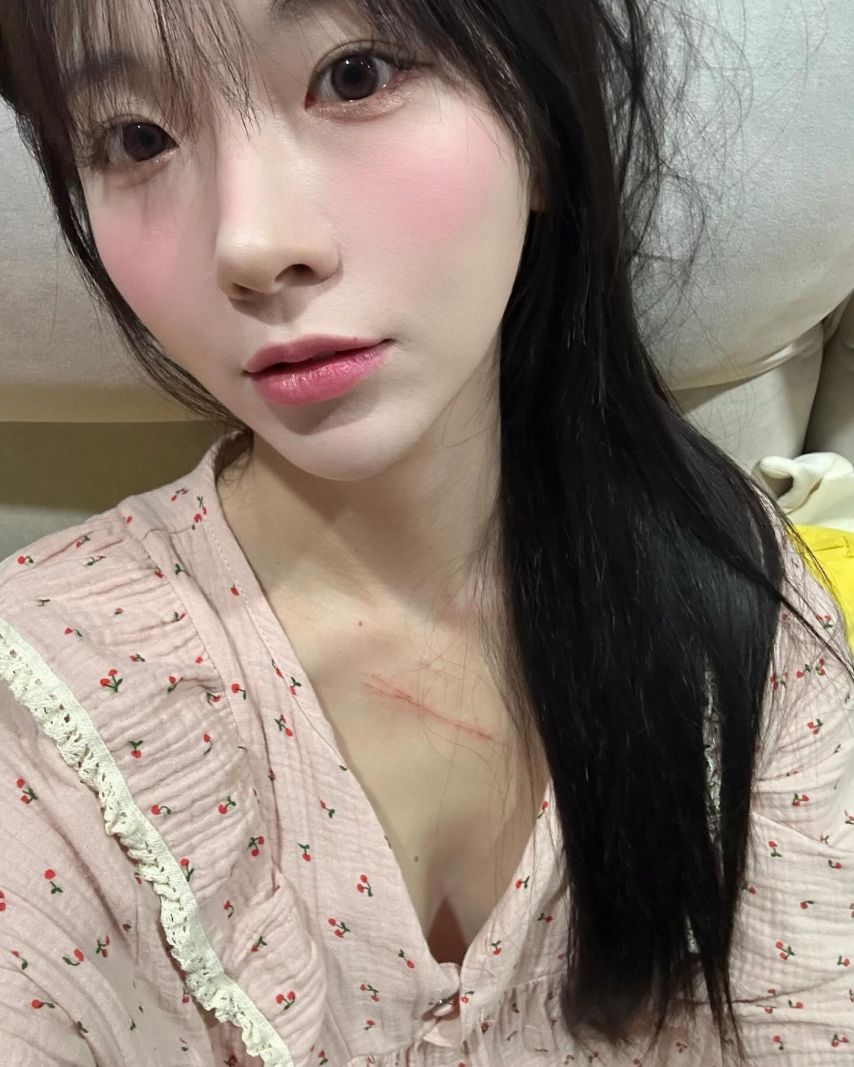 쏘블리