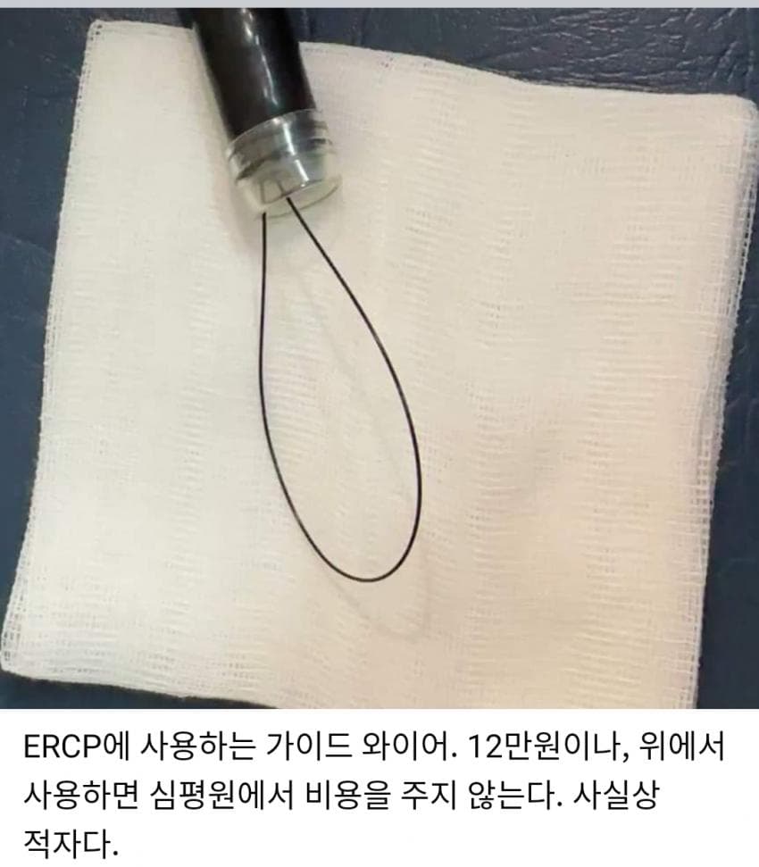 혐)한 의사의 위석 제거 썰