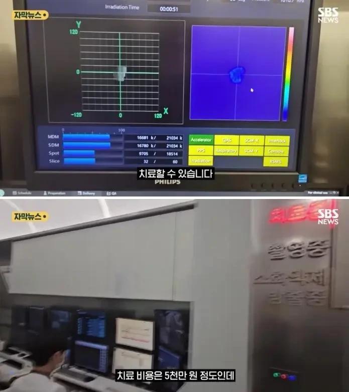 중입자 암치료 기계 성능 근황