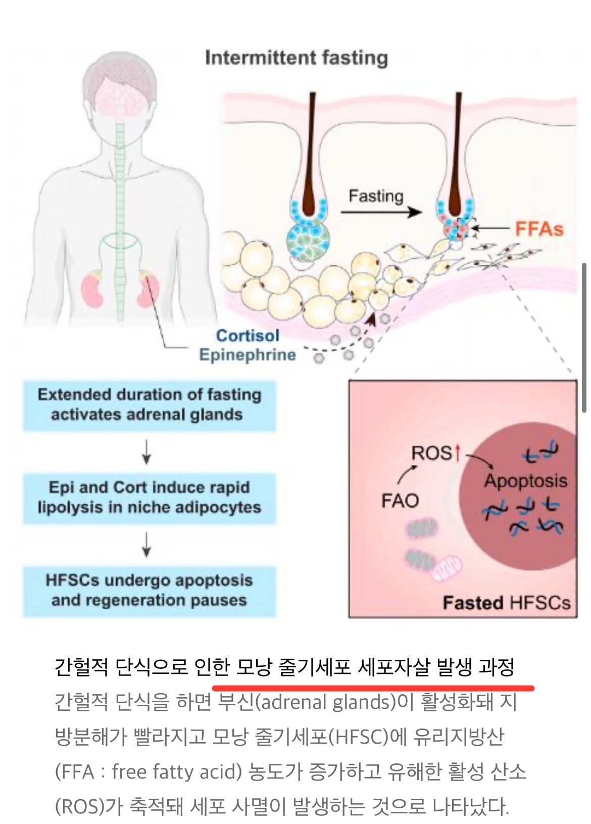 현재 ㅈ됐다는 간혈적단식 연구결과 근황 ㅎㄷㄷㄷㄷ