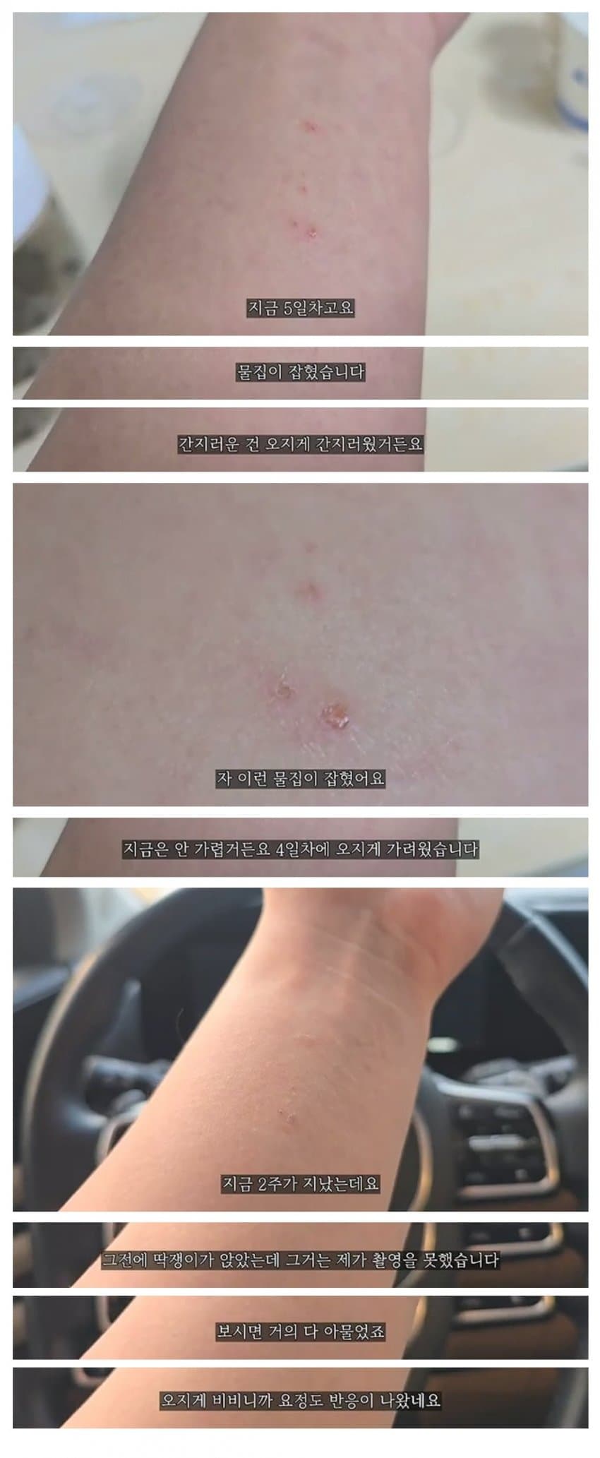 약혐) 스치기만해도 화상을 입는다는 벌레로 실험한 유튜버