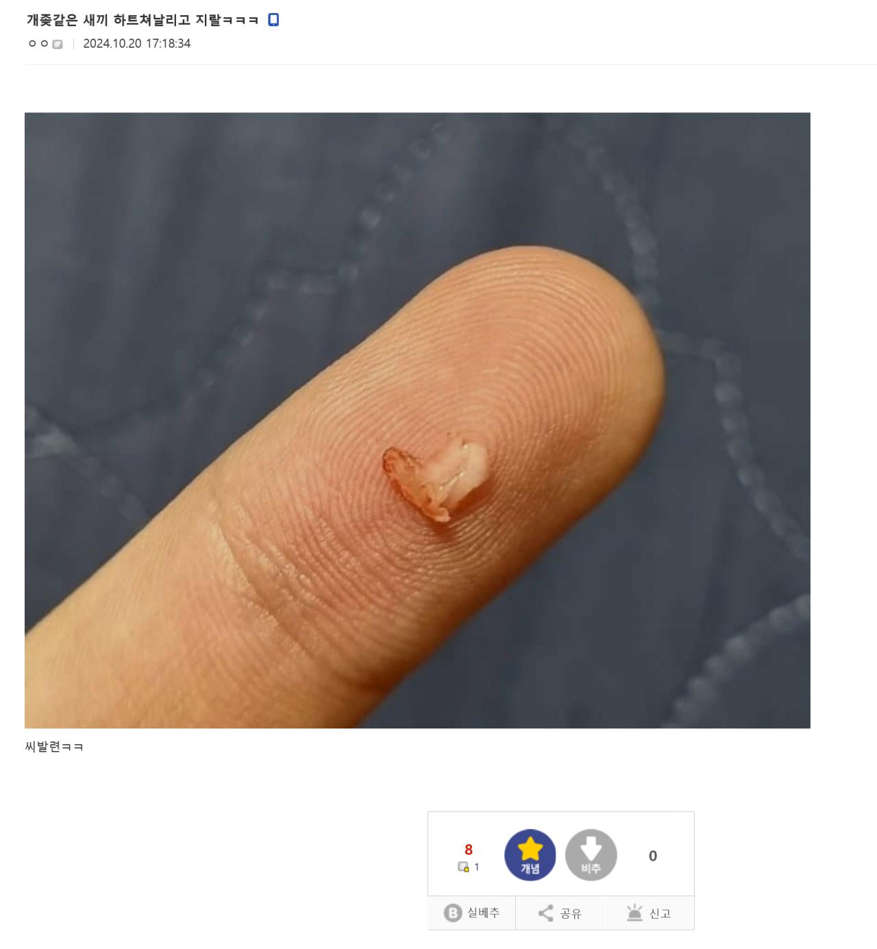 혐)내성발톱 갤러리 레전드
