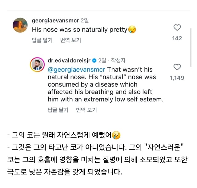 인스타에서 화제된 해외 코성형 전후