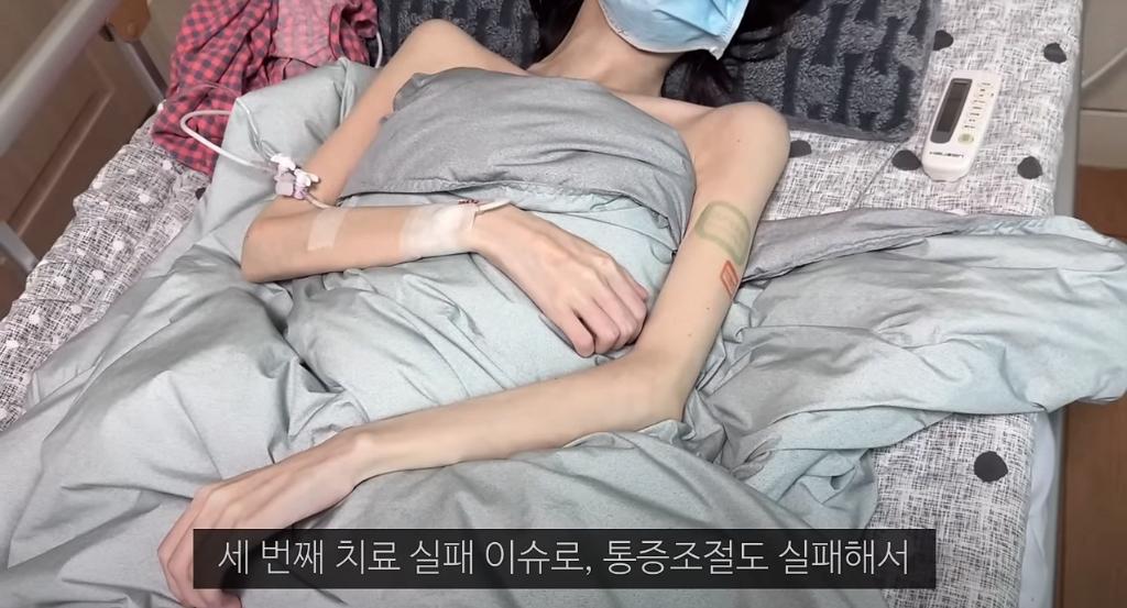 오랜만에 근황 전한 20대 암환자 유튜버