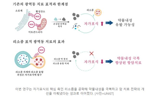 췌장암 빛을 쪼여 제거하는 기술 등장