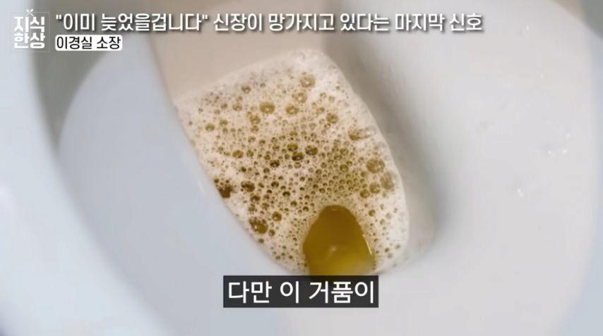 신장이 망가지고 있다는 마지막 신호