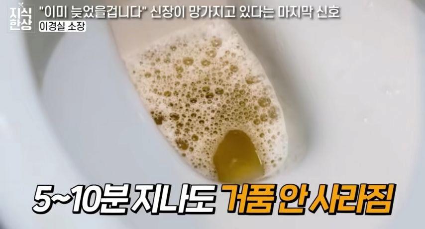 신장이 망가지고 있다는 마지막 신호
