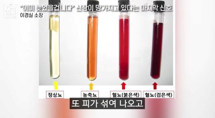 신장이 망가지고 있다는 마지막 신호