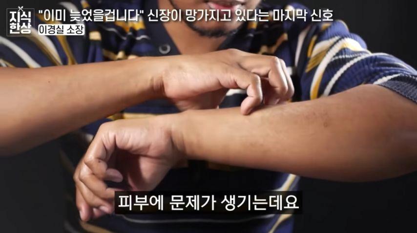 신장이 망가지고 있다는 마지막 신호