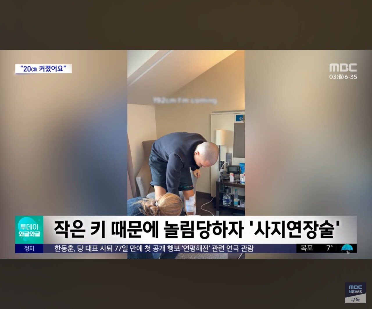 동양인들 이해 못하는 수술