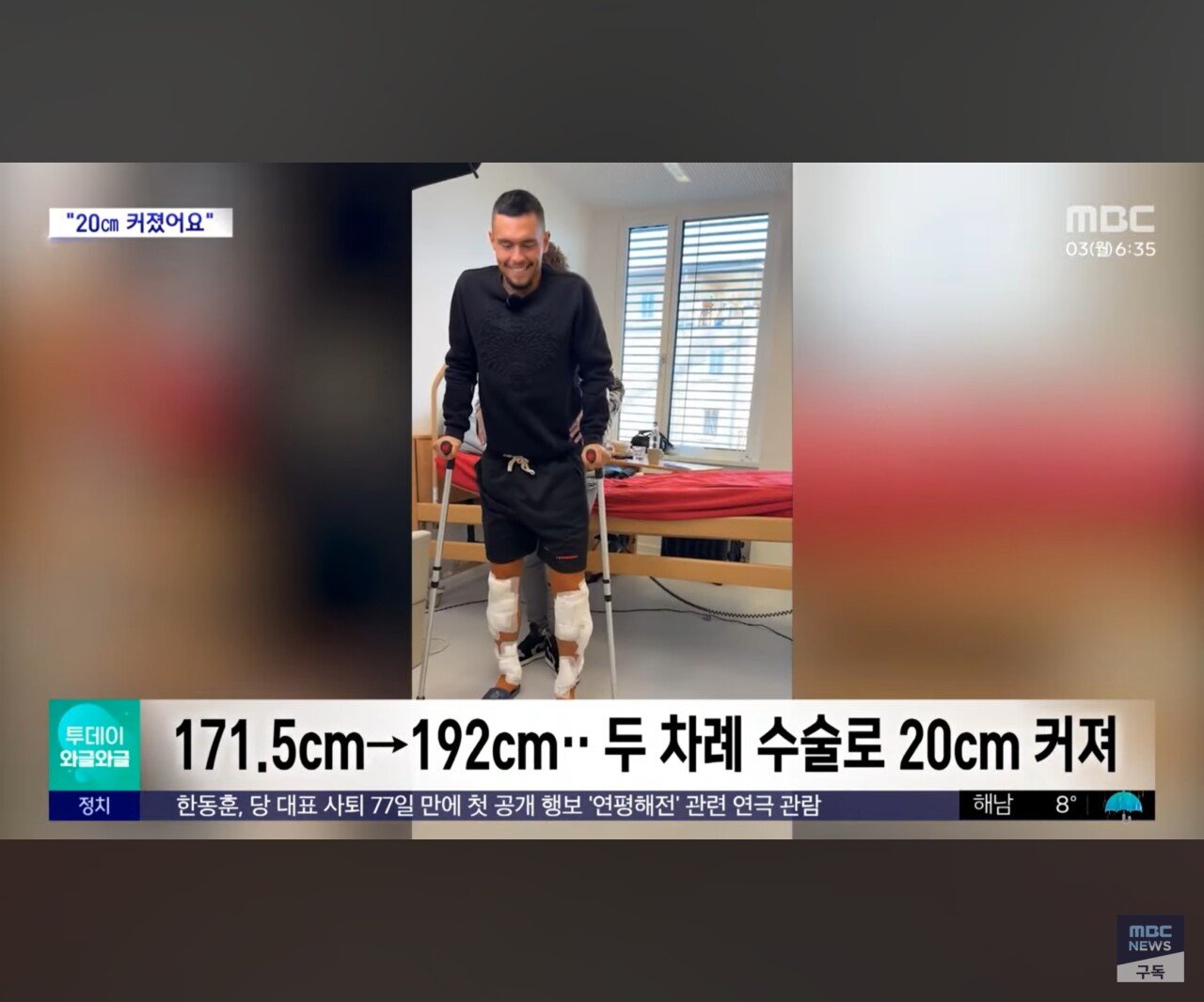 동양인들 이해 못하는 수술