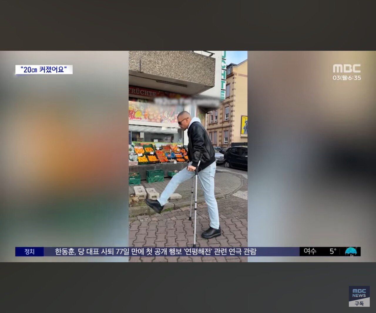 동양인들 이해 못하는 수술