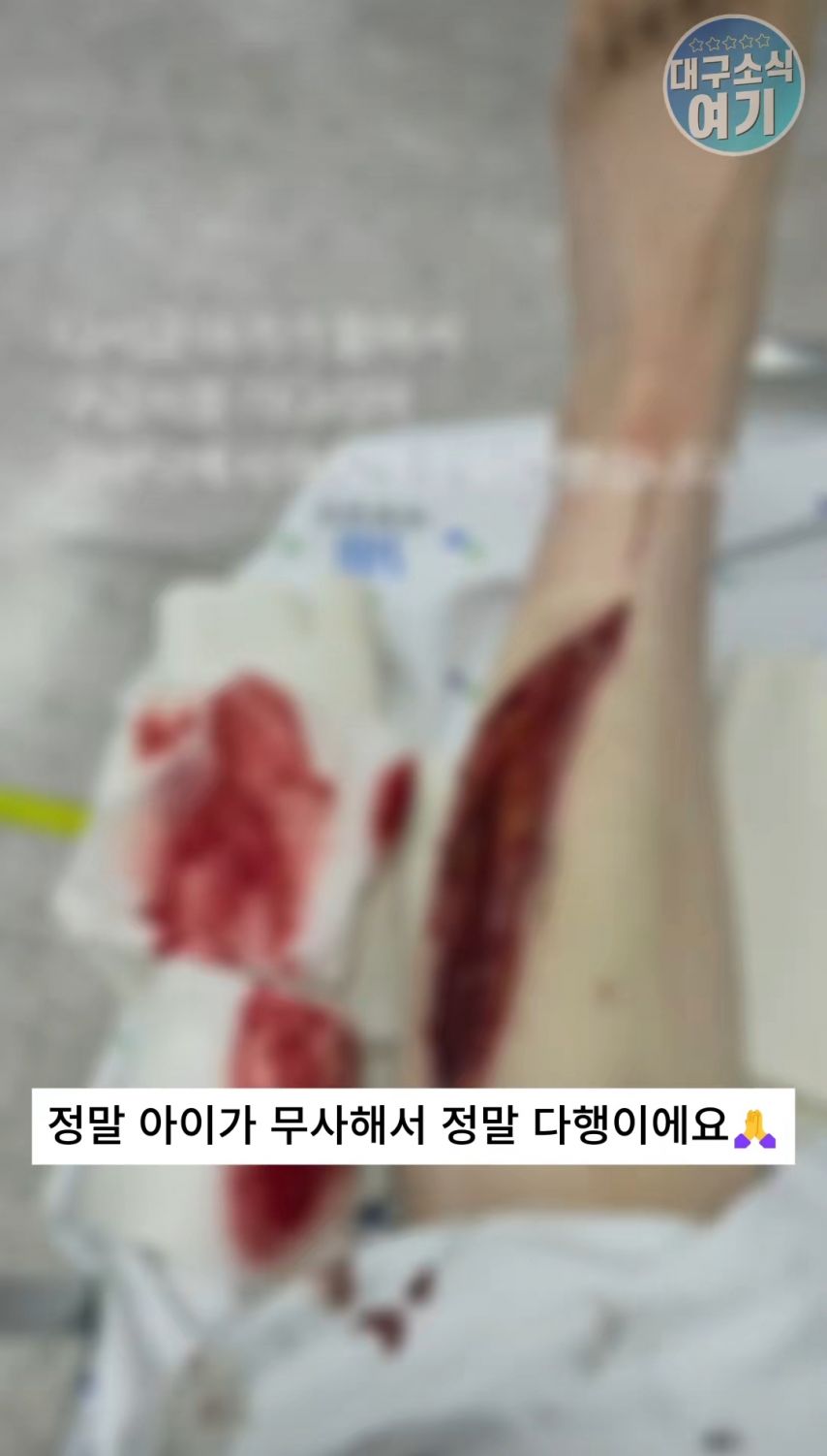 약혐)경산 애엄마의 아찔한 사고