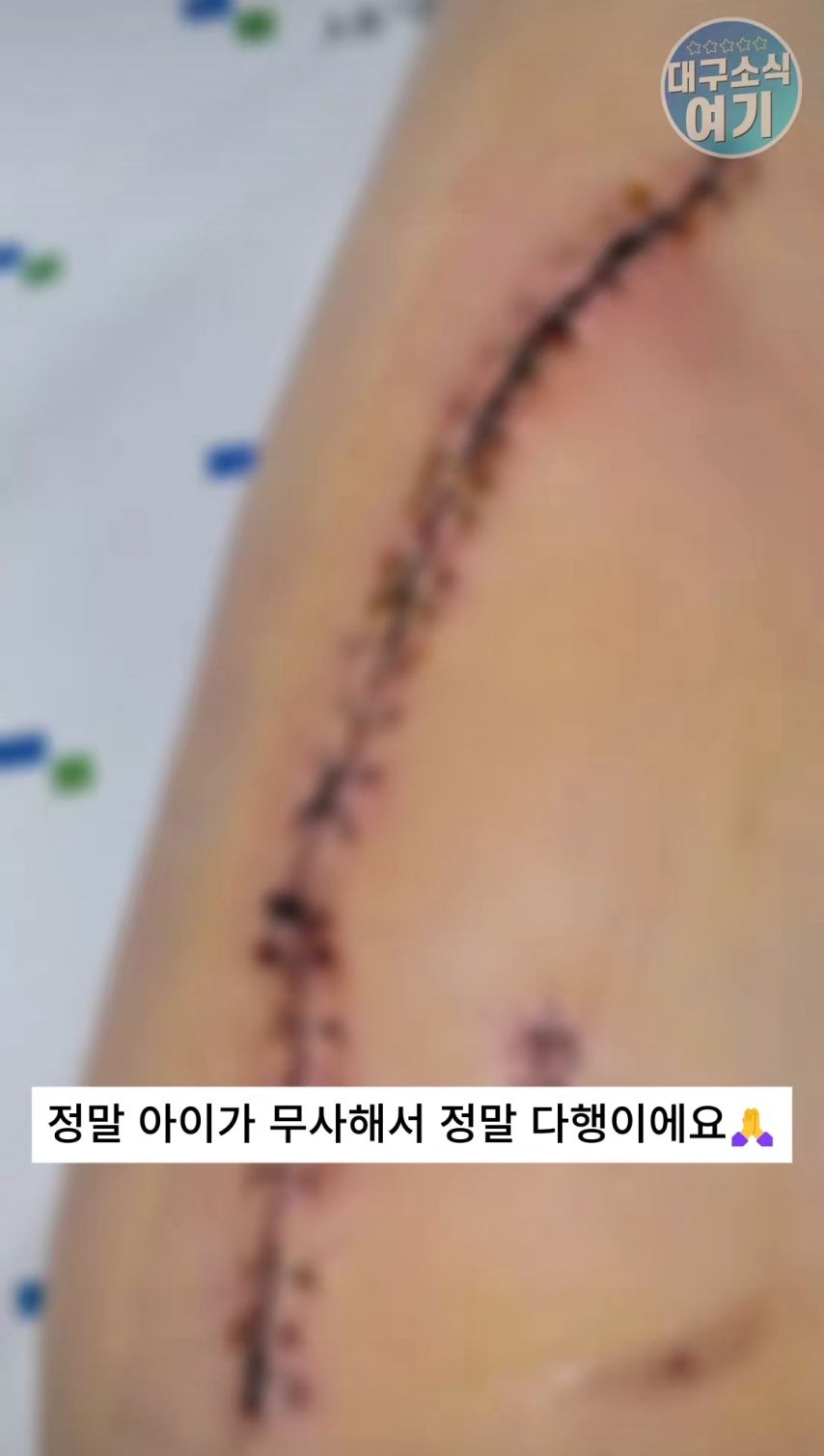 약혐)경산 애엄마의 아찔한 사고